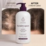 Anit-Hair Loss Strengthens Red Onion Regrowth Hair Growth Shampoo