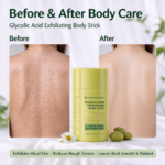 Private Label 10% Glycolic Acid Exfoliating Body Stick Smooth Bumpy Back Bulk Body Scrub