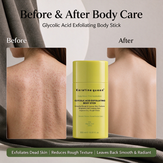 Custom Formula 10% AHA Glycolic Acid Body Exfoliating Stick