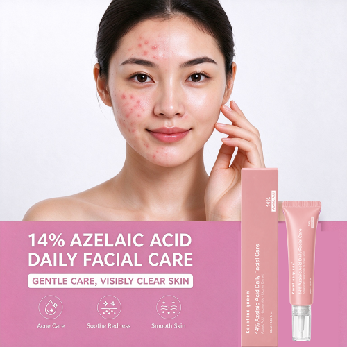 Custom logo 14% Azelaic Acid Repair Cream for Hormonal Acne Redness Rosacea Fade Dark