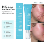 Private Label 14% Azelaic Acid Acne Cream Reduct Redness Sensitive Skin Acne Treatment