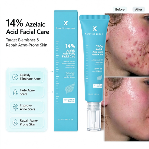 Private Label 14% Azelaic Acid Acne Cream Reduct Redness Sensitive Skin Acne Treatment