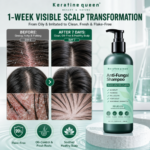 Wholesale Balanced Antifungal Shampoo Salicylic Acid Anti-Dandruff Itching Shampoo